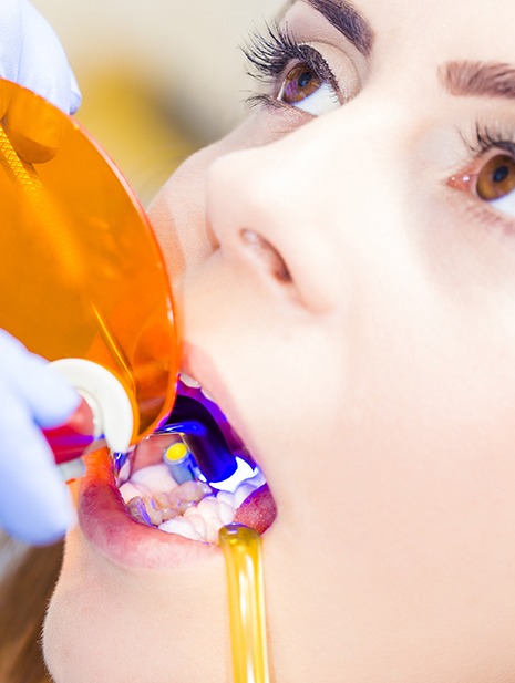 Dental Bonding | SmileCode Dental | NW Calgary | General Dentist