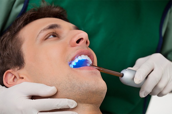 Dental Bonding | SmileCode Dental | NW Calgary | General Dentist