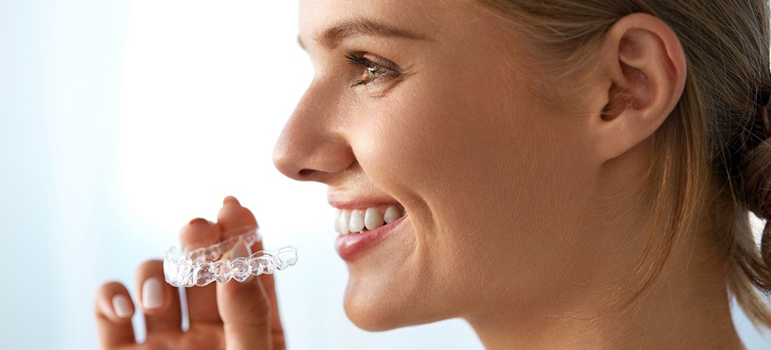 Invisalign Clear Aligners | SmileCode Dental | NW Calgary | General Dentist