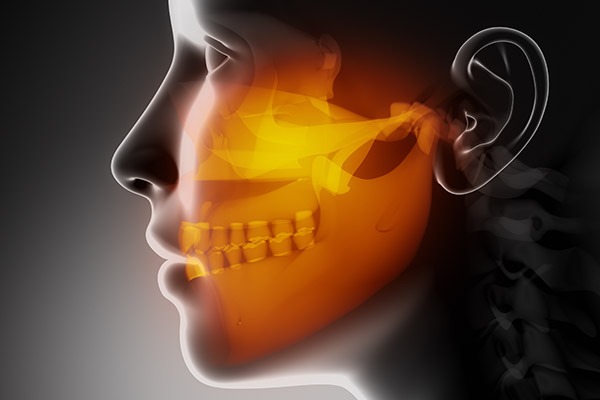 TMD/TMJ Therapy | SmileCode Dental | NW Calgary | General Dentist