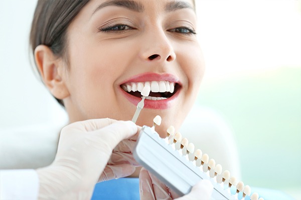 Dental Veneers | SmileCode Dental | NW Calgary | General Dentist